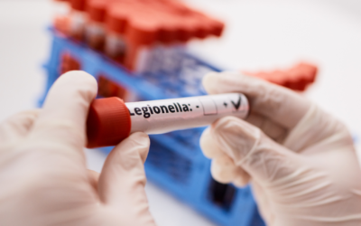 Controllo Legionella: sicurezza e prevenzione in primo piano!
