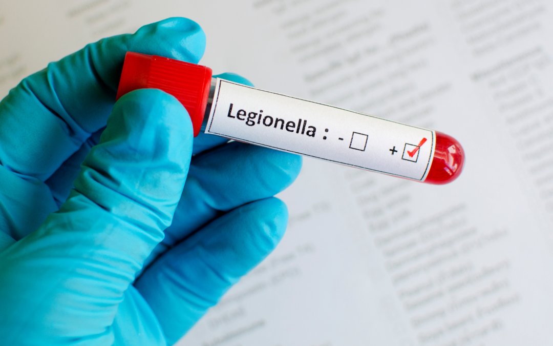 Controllo Legionella: sicurezza e prevenzione in primo piano!